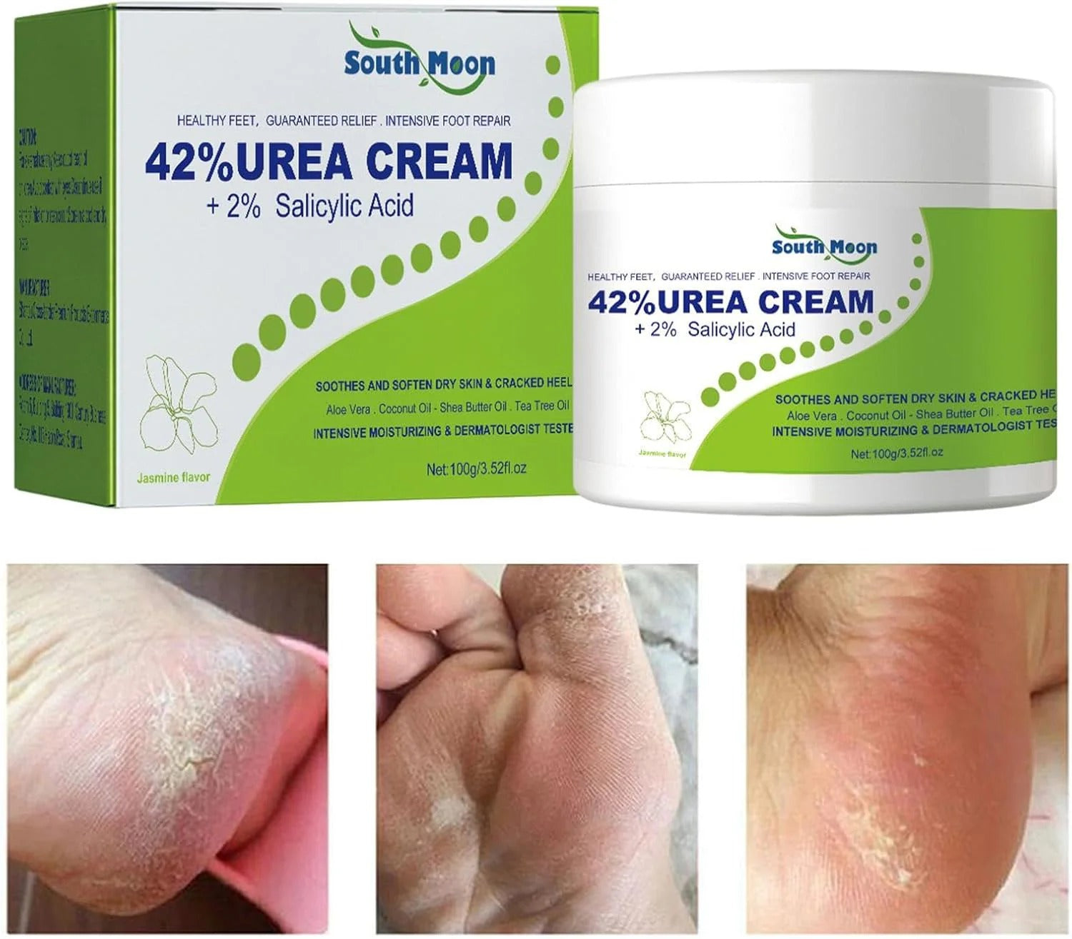 South Moon - 42% Urea Cream + 2% Salicylic Acid
